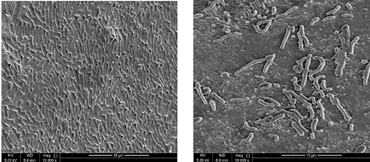 Microscope view of bacteria